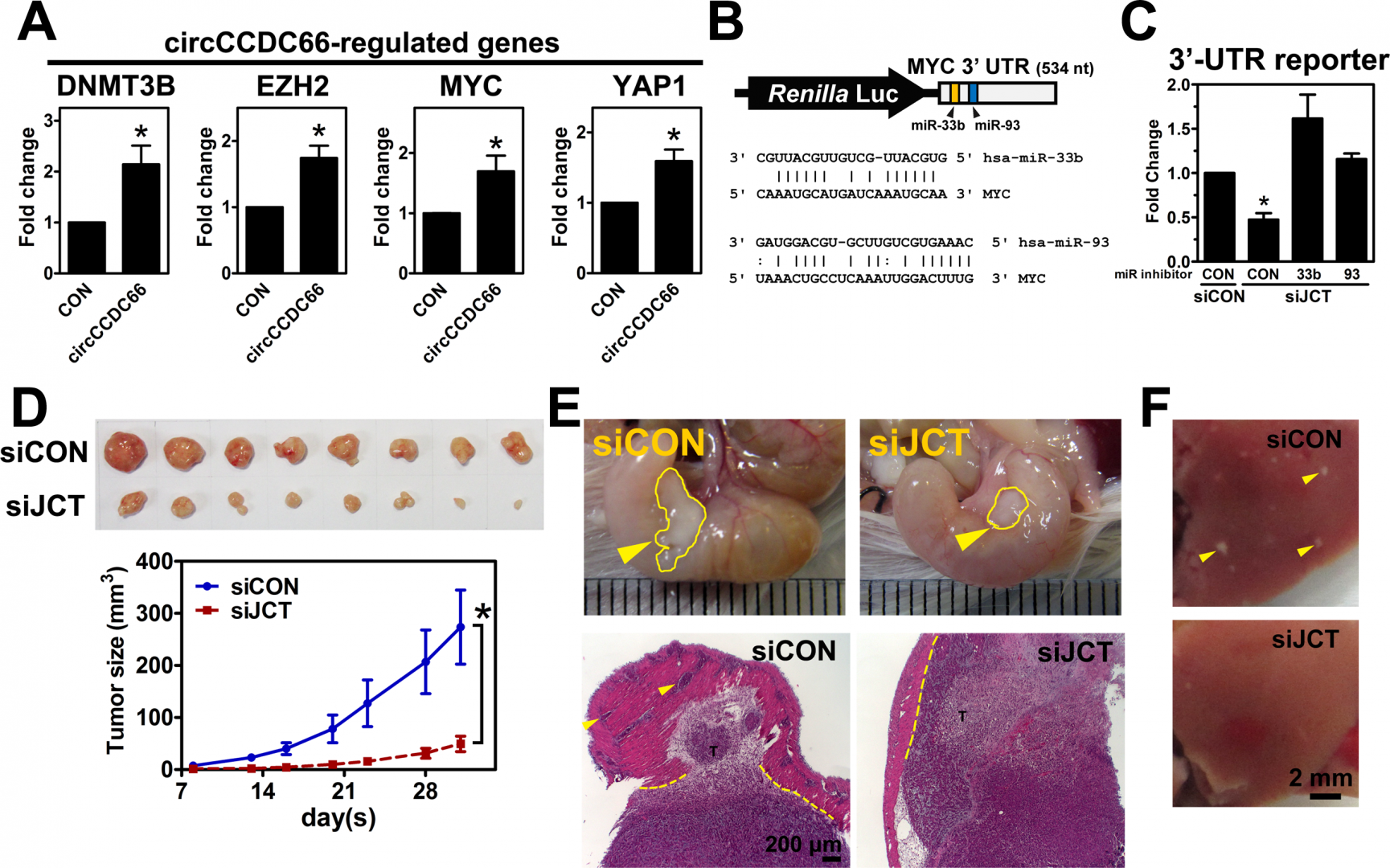 The oncogenic roles of circCCDC66